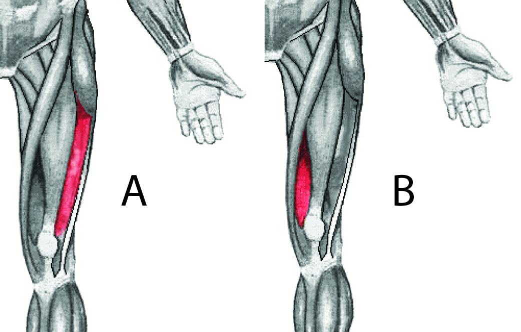 runners-knee-part-1-dc-injury-clinic